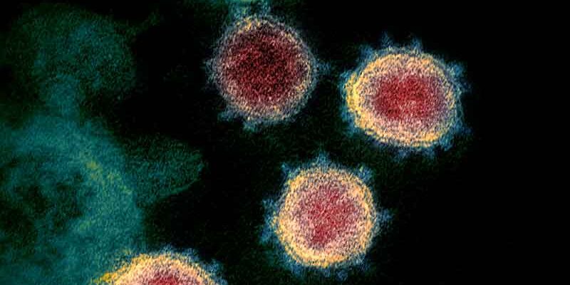 Coronavirus Credit NIAID