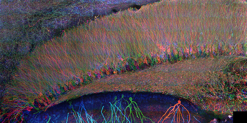 Expansion microscopy Photo Ed Boyden